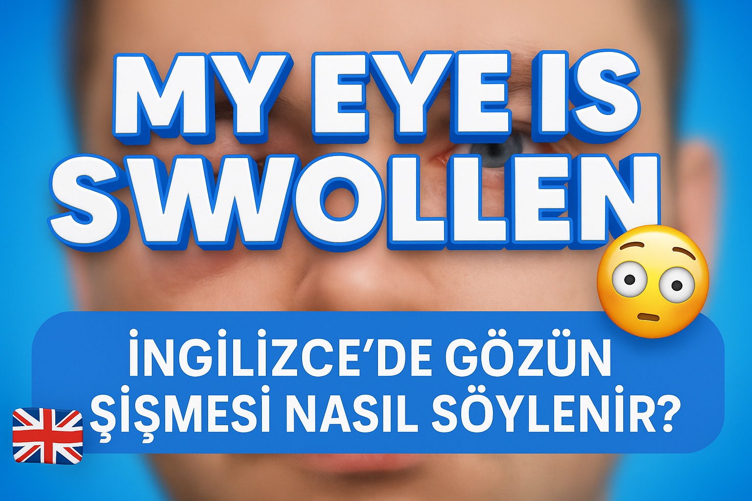 İngilizce’de gözün şişmesi nasıl söylenir?